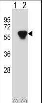 PRKAR2B Antibody - Western blot of PRKAR2B (arrow) using rabbit polyclonal PRKAR2B Antibody. 293 cell lysates (2 ug/lane) either nontransfected (Lane 1) or transiently transfected (Lane 2) with the PRKAR2B gene.