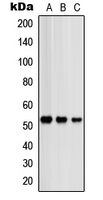 PRKAR2B Antibody - Western blot analysis of PRKAR2B expression in HeLa (A); SHSY5Y (B); NIH3T3 (C) whole cell lysates.