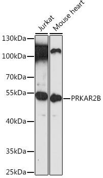 PRKAR2B Antibody - Western blot analysis of extracts of various cell lines, using PRKAR2B antibody at 1:3000 dilution. The secondary antibody used was an HRP Goat Anti-Rabbit IgG (H+L) at 1:10000 dilution. Lysates were loaded 25ug per lane and 3% nonfat dry milk in TBST was used for blocking. An ECL Kit was used for detection and the exposure time was 10s.
