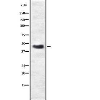 PRKAR2B Antibody - Western blot analysis of PRKAR2B using A549 whole lysates.