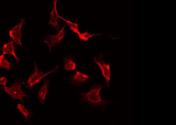 PRKAR2B Antibody - Staining HeLa cells by IF/ICC. The samples were fixed with PFA and permeabilized in 0.1% Triton X-100, then blocked in 10% serum for 45 min at 25°C. The primary antibody was diluted at 1:200 and incubated with the sample for 1 hour at 37°C. An Alexa Fluor 594 conjugated goat anti-rabbit IgG (H+L) Ab, diluted at 1/600, was used as the secondary antibody.