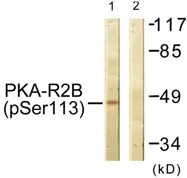 PRKAR2B Antibody - Western blot analysis of lysates from COS7 cells treated with PMA 125ng/ml 30', using PKA-R2 beta (Phospho-Ser113) Antibody. The lane on the right is blocked with the phospho peptide.