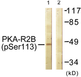 PRKAR2B Antibody - Western blot analysis of lysates from COS7 cells treated with PMA 125ng/ml 30', using PKA-R2 beta (Phospho-Ser113) Antibody. The lane on the right is blocked with the phospho peptide.