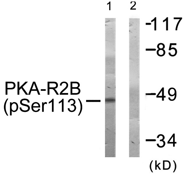 PRKAR2B Antibody - Western blot of extracts from COS-7 cells, treated with PMA (125ng/ml, 30mins), using PKA-R2 beta (Phospho-Ser113) antibody.
