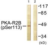 PRKAR2B Antibody - Western blot analysis of extracts from COS-7 cells, treated with PMA (125ng/ml, 30mins), using PKA-R2ß (Phospho-Ser113) antibody.