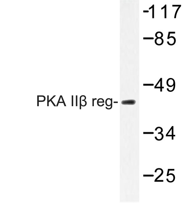 PRKAR2B Antibody - Western blot of PKA II reg (T109) pAb in extracts from Jurkat cells.