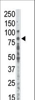 PRKCA / PKC-Alpha Antibody - Western blot of anti-PKCalpha antibody in placenta lysate. PKCalpha (arrow) was detected using purified antibody. Secondary HRP-anti-rabbit was used for signal visualization with chemiluminescence.