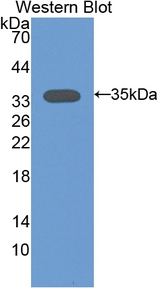 PRKCA / PKC-Alpha Antibody