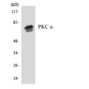 PRKCA / PKC-Alpha Antibody - Western blot analysis of the lysates from HeLa cells using PKC Î± antibody.