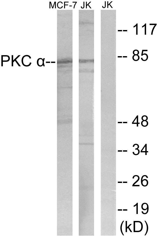 PRKCA / PKC-Alpha Antibody - Western blot analysis of lysates from Jurkat and MCF-7 cells, using PKC alpha Antibody. The lane on the right is blocked with the synthesized peptide.