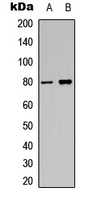 PRKCA / PKC-Alpha Antibody - Western blot analysis of PKC alpha (pT638) expression in HeLa (A); Raw264.7 UV-treated (B) whole cell lysates.