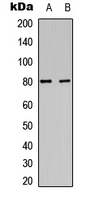 PRKCA / PKC-Alpha Antibody - Western blot analysis of PKC alpha (pY657) expression in HEK293T (A); HepG2 (B) whole cell lysates.