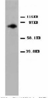 PRKCA / PKC-Alpha Antibody -  This image was taken for the unconjugated form of this product. Other forms have not been tested.