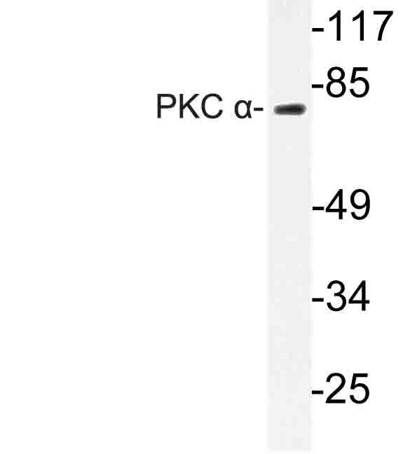 PRKCA / PKC-Alpha Antibody - Western blot of PKC (E653) pAb in extracts from Jurkat cells.