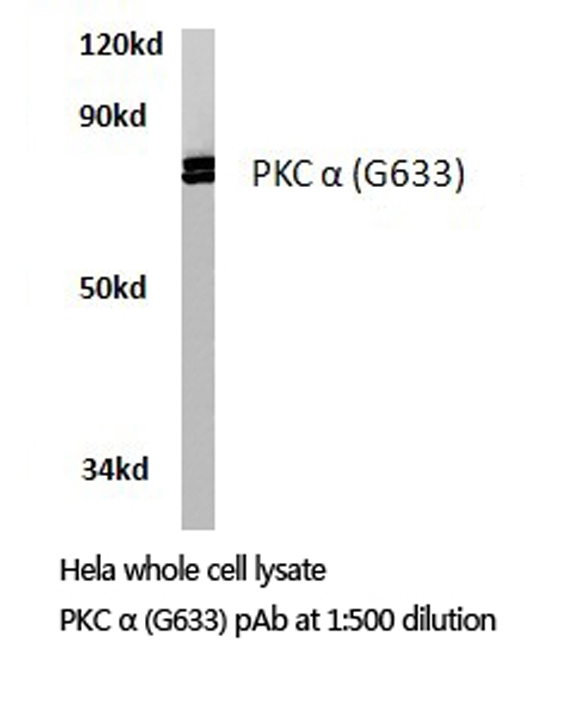 PRKCA / PKC-Alpha Antibody - Western blot of PKC (G633) pAb in extracts from HeLa cells.