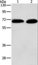 PRKCA / PKC-Alpha Antibody - Western blot analysis of Jurkat and NIH/3T3 cell, using PRKCA Polyclonal Antibody at dilution of 1:500.