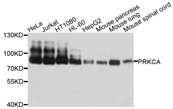 PRKCA / PKC-Alpha Antibody - Western blot analysis of extracts of various cell lines, using PRKCA antibody at 1:1000 dilution. The secondary antibody used was an HRP Goat Anti-Rabbit IgG (H+L) at 1:10000 dilution. Lysates were loaded 25ug per lane and 3% nonfat dry milk in TBST was used for blocking. An ECL Kit was used for detection and the exposure time was 1s.