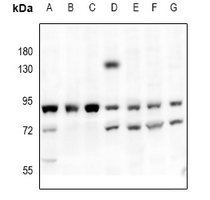 PRKCA / PKC-Alpha Antibody - Western blot analysis of PKC-pan expression in K562 (A), rat brain (B), mouse brain (C), Hela (D), EC9706 (E), LO2 (F), HEK293T (G) whole cell lysates.