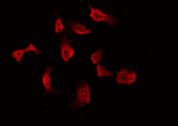 PRKCA / PKC-Alpha Antibody - Staining NIH-3T3 cells by IF/ICC. The samples were fixed with PFA and permeabilized in 0.1% Triton X-100, then blocked in 10% serum for 45 min at 25°C. The primary antibody was diluted at 1:200 and incubated with the sample for 1 hour at 37°C. An Alexa Fluor 594 conjugated goat anti-rabbit IgG (H+L) Ab, diluted at 1/600, was used as the secondary antibody.