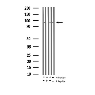 PRKCA / PKC-Alpha Antibody - Western blot analysis of Phospho-PKC-pan (Thr497) expression in various lysates