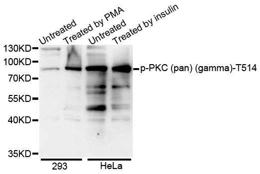 PRKCA / PKC-Alpha Antibody - Western blot analysis of extracts of various cell lines.