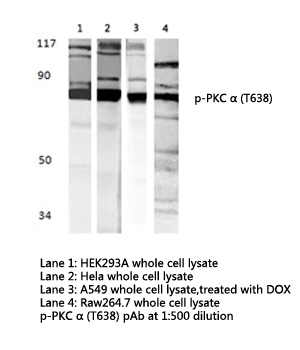 PRKCA / PKC-Alpha Antibody - Western blot of p-PKC (T638) pAb in extracts from HEK293A, HeLa, A549 (treated with DOX) and Raw264.7 cells.
