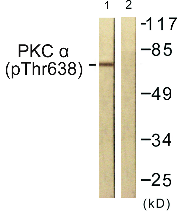 PRKCA / PKC-Alpha Antibody - Western blot analysis of lysates from NIH/3T3 cells treated with UV 15', using PKC alpha (Phospho-Thr638) Antibody. The lane on the right is blocked with the phospho peptide.