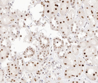 PRKCA / PKC-Alpha Antibody - 1:200 staining human kidney tissue by IHC-P. The tissue was formaldehyde fixed and a heat mediated antigen retrieval step in citrate buffer was performed. The tissue was then blocked and incubated with the antibody for 1.5 hours at 22°C. An HRP conjugated goat anti-rabbit antibody was used as the secondary.