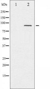 PRKCA / PKC-Alpha Antibody - Western blot analysis of PKC alpha phosphorylation expression in UV treated NIH-3T3 whole cells lysates. The lane on the left is treated with the antigen-specific peptide.
