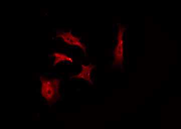 PRKCA / PKC-Alpha Antibody - Staining NIH-3T3 cells by IF/ICC. The samples were fixed with PFA and permeabilized in 0.1% Triton X-100, then blocked in 10% serum for 45 min at 25°C. The primary antibody was diluted at 1:200 and incubated with the sample for 1 hour at 37°C. An Alexa Fluor 594 conjugated goat anti-rabbit IgG (H+L) Ab, diluted at 1/600, was used as the secondary antibody.