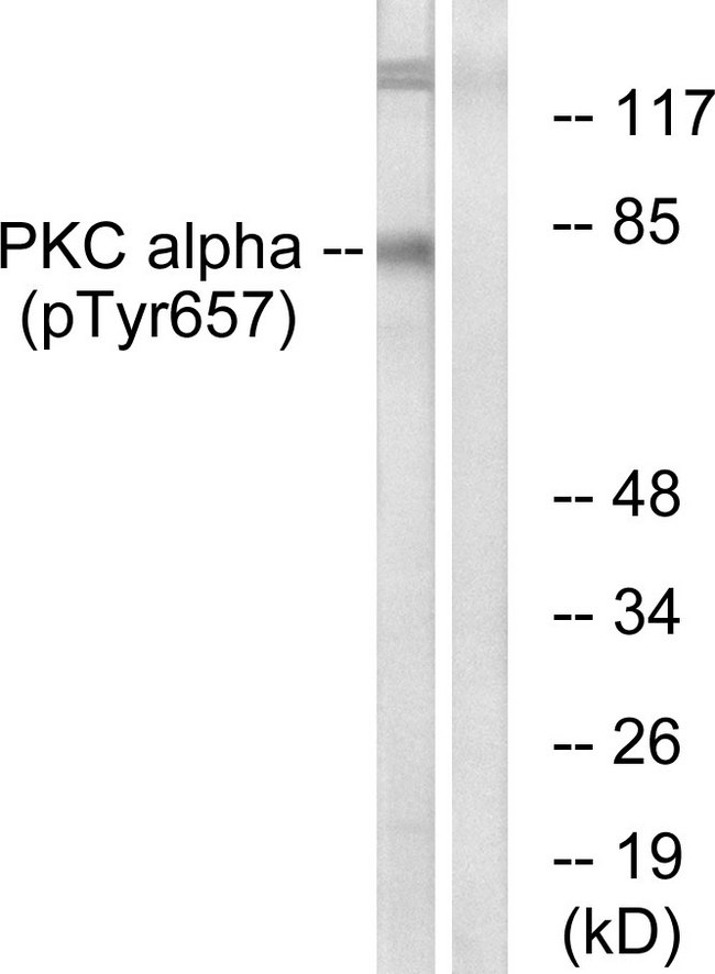 PRKCA / PKC-Alpha Antibody - Western blot analysis of lysates from COLO205 cells, using PKC alpha (Phospho-Tyr657) Antibody. The lane on the right is blocked with the phospho peptide.