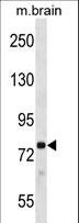 PRKCB / PKC-Beta Antibody - Mouse Prkcb Antibody western blot of mouse brain tissue lysates (35 ug/lane). The Prkcb antibody detected the Prkcb protein (arrow).