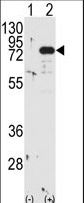 PRKCB / PKC-Beta Antibody - Western blot of PRKCB (arrow) using PKC beta1/2 Antibody. 293 cell lysates (2 ug/lane) either nontransfected (Lane 1) or transiently transfected with the PRKCB gene (Lane 2) (Origene Technologies).