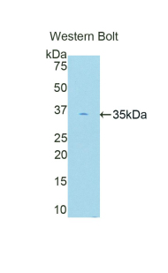 PRKCB / PKC-Beta Antibody - Western blot of recombinant PRKCB / PKC-Beta.  This image was taken for the unconjugated form of this product. Other forms have not been tested.