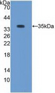 PRKCB / PKC-Beta Antibody - Western Blot; Sample: Recombinant PKCb1, Rabbit.