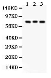 PRKCB / PKC-Beta Antibody - PKC beta 1 antibody Western blot. All lanes: Anti PKC beta 1 at 0.5 ug/ml. Lane 1: Rat Brain Tissue Lysate at 50 ug. Lane 2: Mouse Brain Tissue Lysate at 50 ug. Lane 3: COLO320 Whole Cell Lysate at 40 ug. Predicted band size: 77 kD. Observed band size: 77 kD.