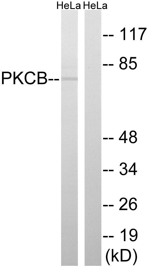 PRKCB / PKC-Beta Antibody - Western blot analysis of lysates from HeLa cells, using PKCB Antibody. The lane on the right is blocked with the synthesized peptide.