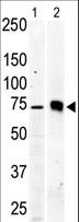 PRKCB / PKC-Beta Antibody - The anti-PKC beta2 antibody is used in Western blot to detect PKC beta2 in Jurkat cell lysate (lane 1) and mouse brain tissue lysate (lane 2).