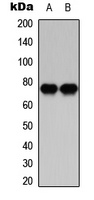 PRKCB / PKC-Beta Antibody - Western blot analysis of PKC beta expression in HeLa (A); Raw264.7 (B) whole cell lysates.