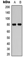 PRKCB / PKC-Beta Antibody - Western blot analysis of PKC beta (pS661) expression in K562 PMA-treated (A); HeLa (B) whole cell lysates.