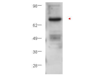 PRKCB / PKC-Beta Antibody - Anti-PKC Beta Antibody - Western Blot. Western blot of affinity purified anti-PKC beta antibody shows detection of PKC beta in ~25 ug of U251 whole cell lysate (glioma derived). A 4-12% gel was used for separation. The arrowhead corresponds to 76 kD PKC beta. The membrane was probed with the primary antibody at a 1:1000 dilution in 5% BSA in TTBS at 4C, overnight. Personal Communication, Howard Fine and Svetlana Kotliarova, CCR-NCI, Bethesda, MD.