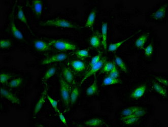 PRKCB / PKC-Beta Antibody - Immunofluorescent analysis of Hela cells at a dilution of 1:100 and Alexa Fluor 488-congugated AffiniPure Goat Anti-Rabbit IgG(H+L)