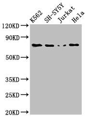 PRKCB / PKC-Beta Antibody - Positive Western Blot detected in K562 whole cell lysate, SH-SY5Y whole cell lysate, Jurkat whole cell lysate, Hela whole cell lysate. All lanes: PRKCB antibody at 3 µg/ml Secondary Goat polyclonal to rabbit IgG at 1/50000 dilution. Predicted band size: 77, 78 KDa. Observed band size: 77 KDa