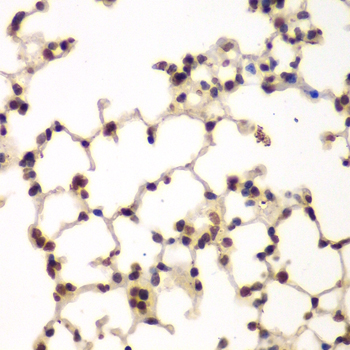 PRKCB / PKC-Beta Antibody - Immunohistochemistry of paraffin-embedded mouse lung using PRKCB antibody at dilution of 1:200 (40x lens).
