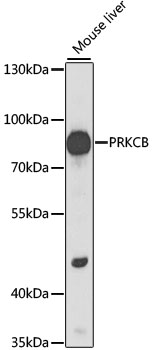 PRKCB / PKC-Beta Antibody - Western blot analysis of extracts of mouse liver, using PRKCB antibody at 1:1000 dilution. The secondary antibody used was an HRP Goat Anti-Rabbit IgG (H+L) at 1:10000 dilution. Lysates were loaded 25ug per lane and 3% nonfat dry milk in TBST was used for blocking. An ECL Kit was used for detection and the exposure time was 50s.