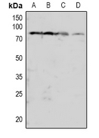 PRKCB / PKC-Beta Antibody - Western blot analysis of PKC beta (pT641) expression in Hela (A), HEK293T (B), mouse brain (C), rat brain (D) whole cell lysates.