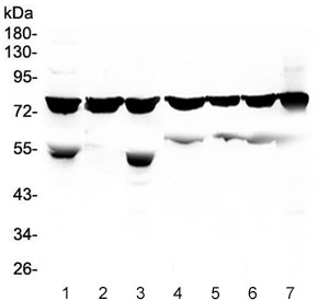 PRKCB / PKC-Beta Antibody - Western blot testing of human 1) K562, 2) THP-1, 3) HEK293, 4) Jurkat, 5) Raji, 6) HL-60 and 7) A549 lysate with PKC beta antibody at 0.5ug/ml. Predicted molecular weight ~76 kDa.