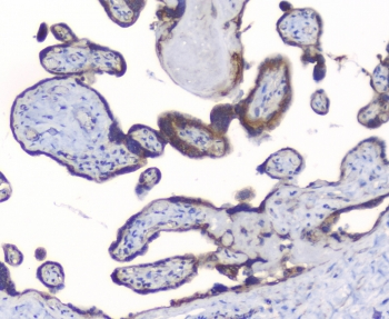 PRKCB / PKC-Beta Antibody - IHC staining of FFPE human placenta with PKC beta antibody at 1ug/ml. HIER: boil tissue sections in pH6, 10mM citrate buffer, for 10-20 min followed by cooling at RT for 20 min.