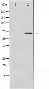 PRKCB / PKC-Beta Antibody - Western blot analysis of PKCB expression in HeLa whole cells lysates. The lane on the left is treated with the antigen-specific peptide.