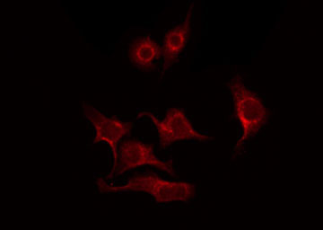 PRKCB / PKC-Beta Antibody - Staining HeLa cells by IF/ICC. The samples were fixed with PFA and permeabilized in 0.1% Triton X-100, then blocked in 10% serum for 45 min at 25°C. The primary antibody was diluted at 1:200 and incubated with the sample for 1 hour at 37°C. An Alexa Fluor 594 conjugated goat anti-rabbit IgG (H+L) Ab, diluted at 1/600, was used as the secondary antibody.